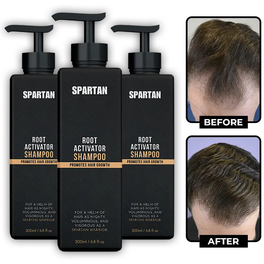 Spartan Root Activator Shampoo — 3 Extra Bottles (30% OFF)